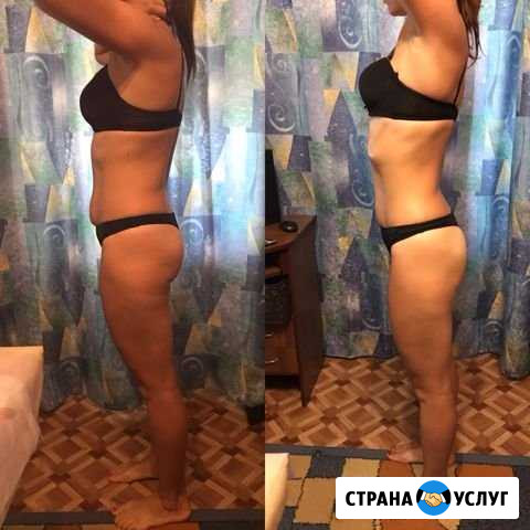 Коррекция фигуры Волгоград - изображение 1