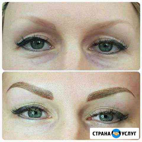 Удаление татуажа, микроблейдинга, напыления ремуве Курск