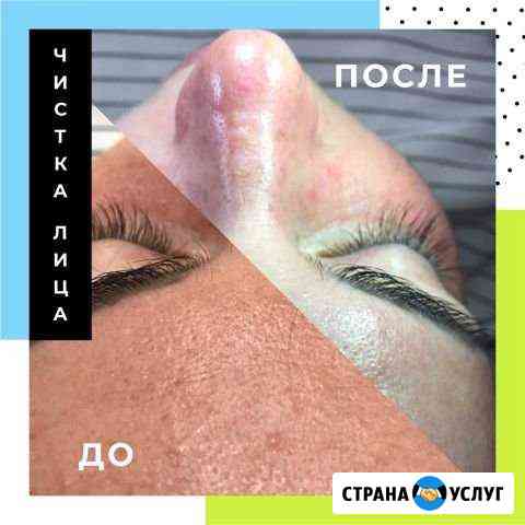 Чиста лица + экспресс массаж лица в подарок Омск