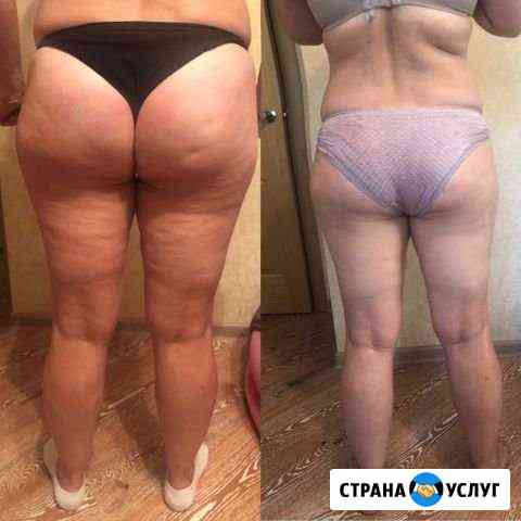 Массаж Самара