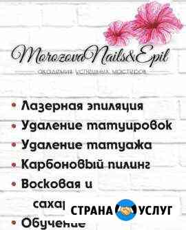 Лазерное удаление тату Казань