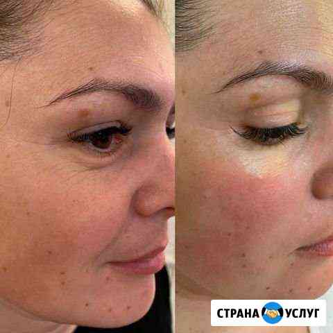 Ультраформер Симферополь