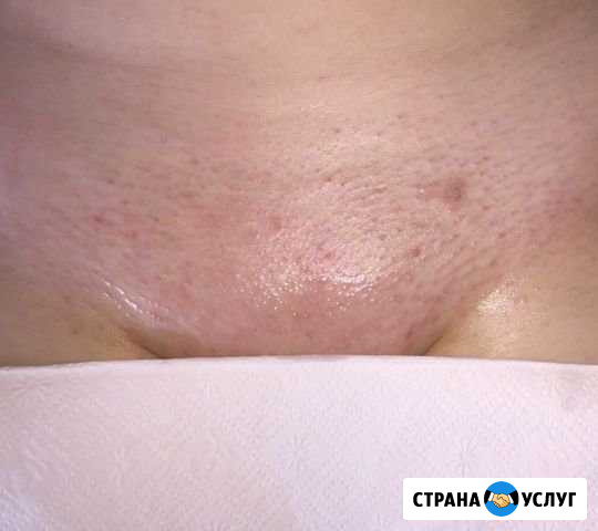 Мужской и женский шугаринг, восковая депиляция Ижевск - изображение 1