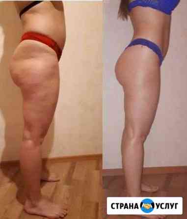 Антицеллюлитный массаж Санкт-Петербург