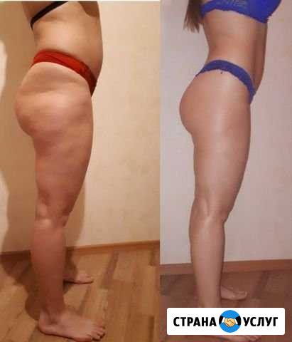 Антицеллюлитный массаж Санкт-Петербург - изображение 1