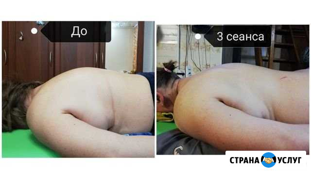 Биоэнергетический Массаж Ижевск - изображение 1