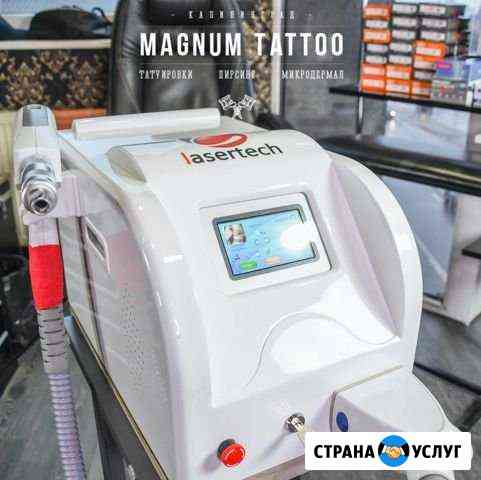 Лазерное удаление тату Калининград