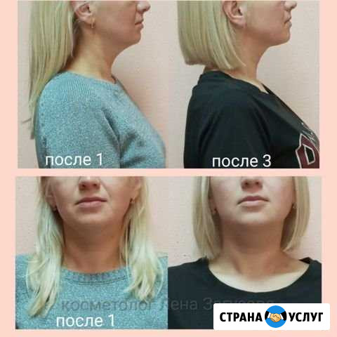 Эко-косметолог. Витапластика. Массаж Калининград - изображение 1