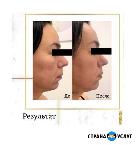 Японский массаж лица «Кобидо» Пермь - изображение 1