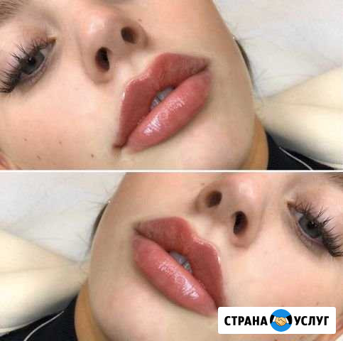 Губы Коммунарка - изображение 1
