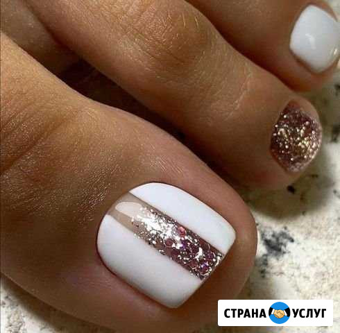 Педикюр Калининград - изображение 1