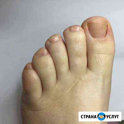 Педикюр Пермь