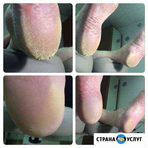 Педикюр гель-лак шеллак маникюр Мурманск