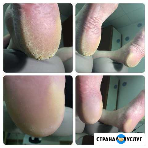 Педикюр гель-лак шеллак маникюр Мурманск - изображение 1