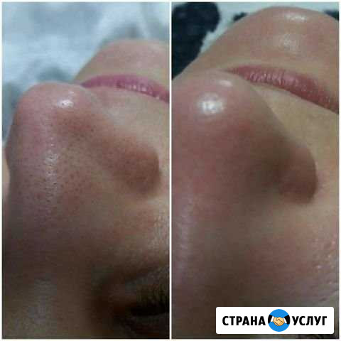 Уход за лицом Оренбург - изображение 1