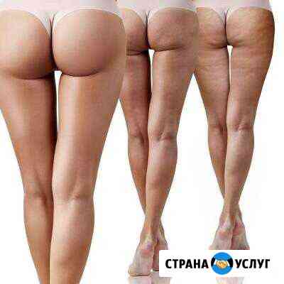 Антицеллюлитный аппаратный массаж на дерматонике Нижний Тагил