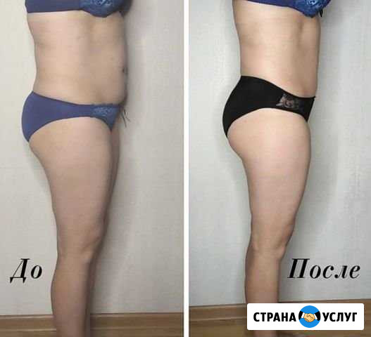 Массаж Волгоград - изображение 1