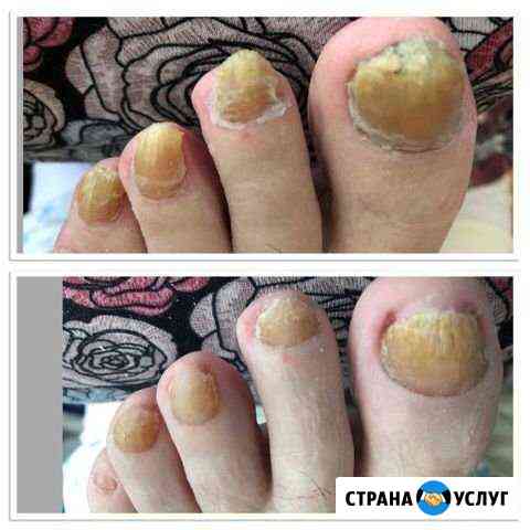 Педикюр Симферополь