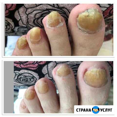Педикюр Симферополь - изображение 1