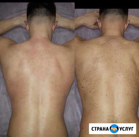 Шугаринг мужской и женский Тула - изображение 1