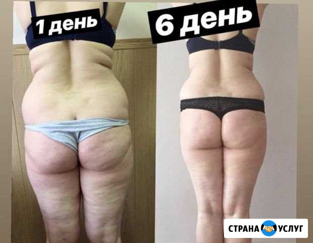 Массаж Махачкала - изображение 1