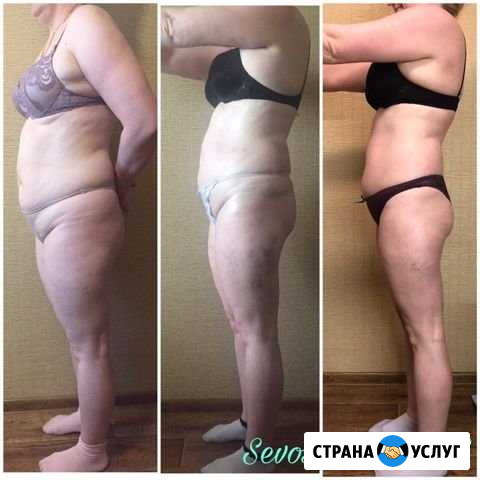 Вакуумный массаж Набережные Челны - изображение 1