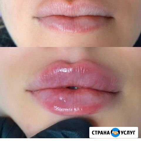 Врач косметолог Махачкала - изображение 1
