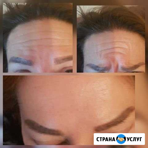 Косметолог Ольга Электросталь - изображение 1