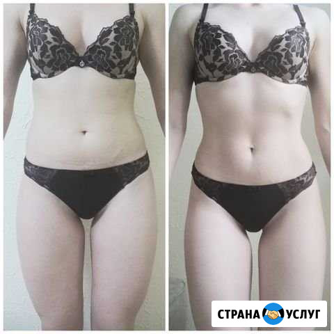 Массаж, антицеллюлитный массаж Краснодар - изображение 1