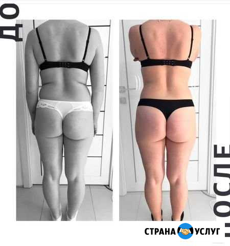 Коррекция фигуры на аппарате Skills Body Магадан - изображение 1