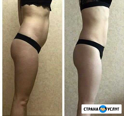 Массаж Красногорск - изображение 1