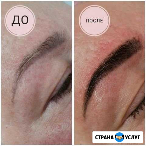 Шугаринг Приморско-Ахтарск - изображение 1