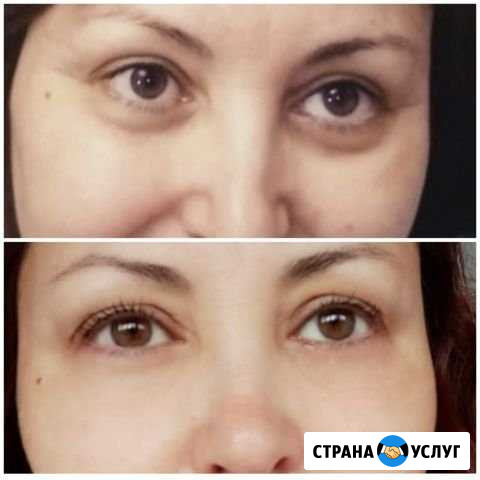 Ламинирование ресниц Уфа - изображение 1