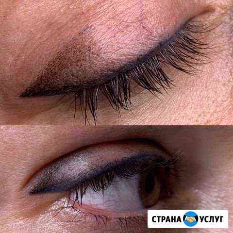 Перманентный макияж. Удаление старого татуажа Омск