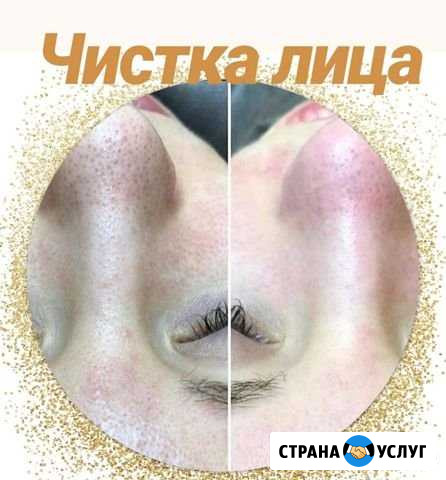 Косметолог юмр/массаж лица юмр Краснодар - изображение 1