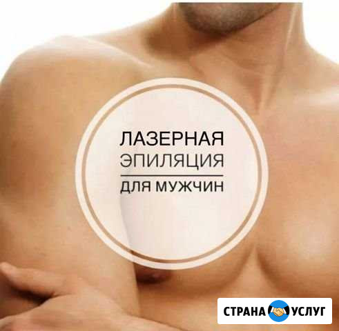 Мужская лазерная эпиляция Саратов - изображение 1