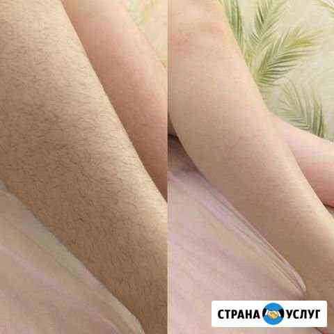 Депиляция,шугаринг Казань