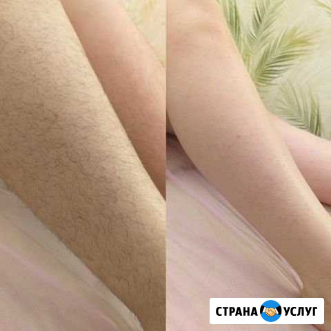 Депиляция,шугаринг Казань - изображение 1