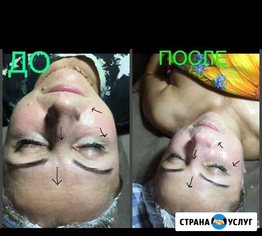 Косметолог Севастополь - изображение 1