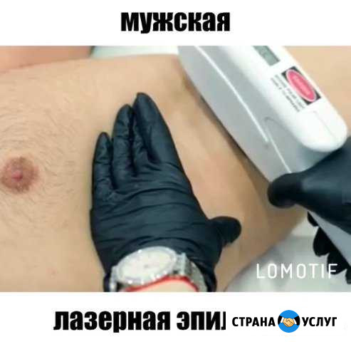 Лазерная Эпиляция для мужчин Ростов-на-Дону - изображение 1