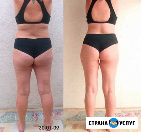 Антицеллюлитный массаж для похудения Краснодар - изображение 1