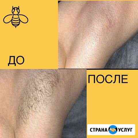 Шугаринг Дзержинск