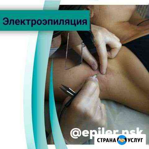 Электроэпиляция Новосибирск