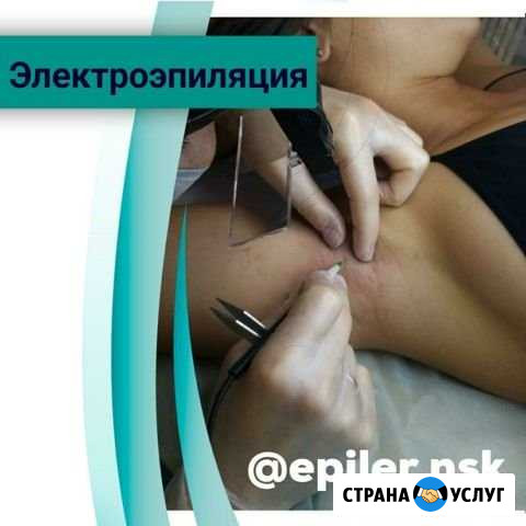 Электроэпиляция Новосибирск - изображение 1