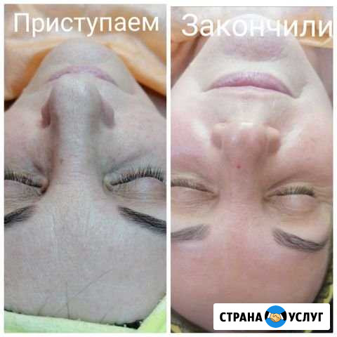 Косметолог Барнаул - изображение 1