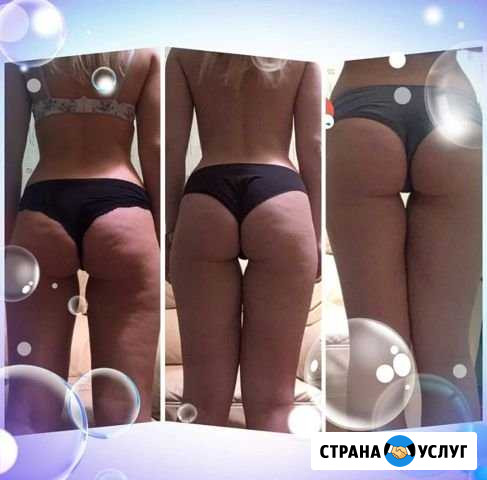 Антицеллюлитный массаж Красноярск - изображение 1