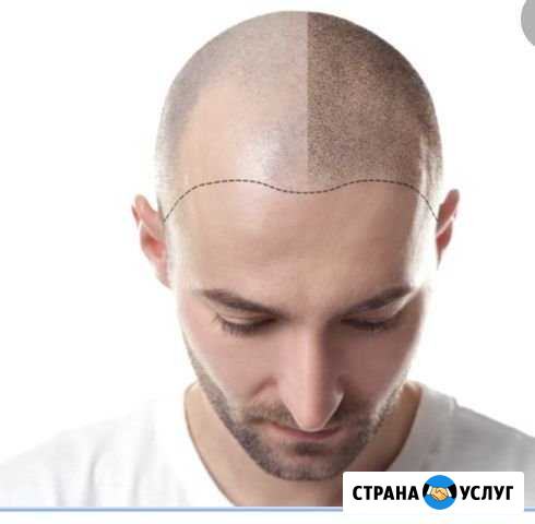Имитация волос, перманентный макияж головы Махачкала - изображение 1