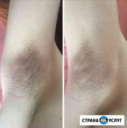 Ваксинг депиляция воском Магнитогорск