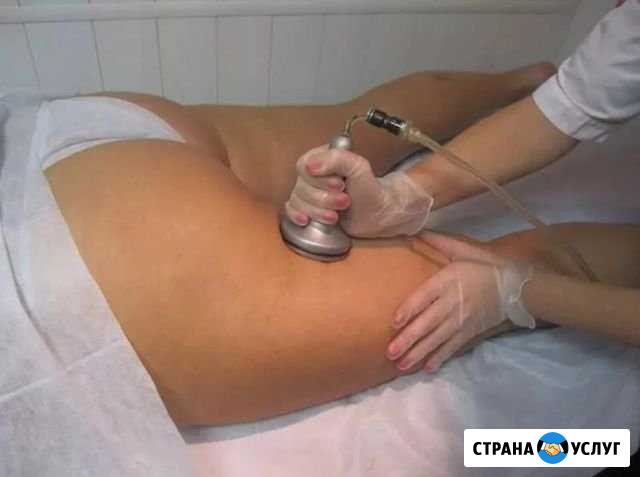 Аппаратный вакуумно- роликовый массаж Алексеевка Самарской области - изображение 1