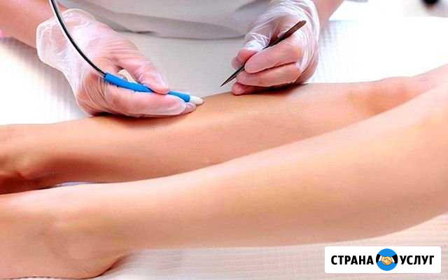 Чистка лица, электроэпиляция Казань - изображение 1